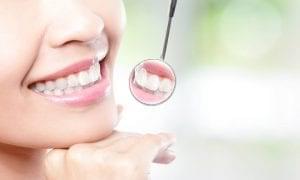 Igiena orala: reguli si masuri de precautie